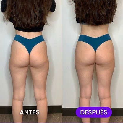 Gummies Glutea+ Levantado y Definición Glúteos